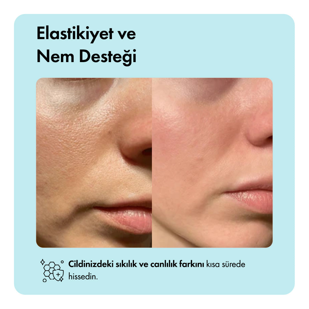 Zero Pore™ Temizleme Barı ys-zeropore-cod