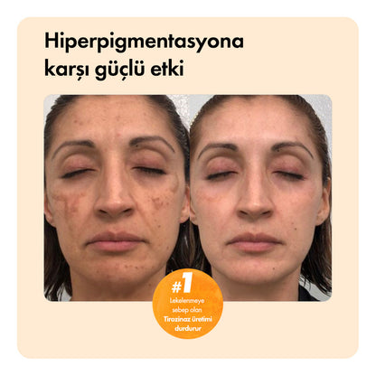 Kojiso™ Temizleme Barı ys-kojiso