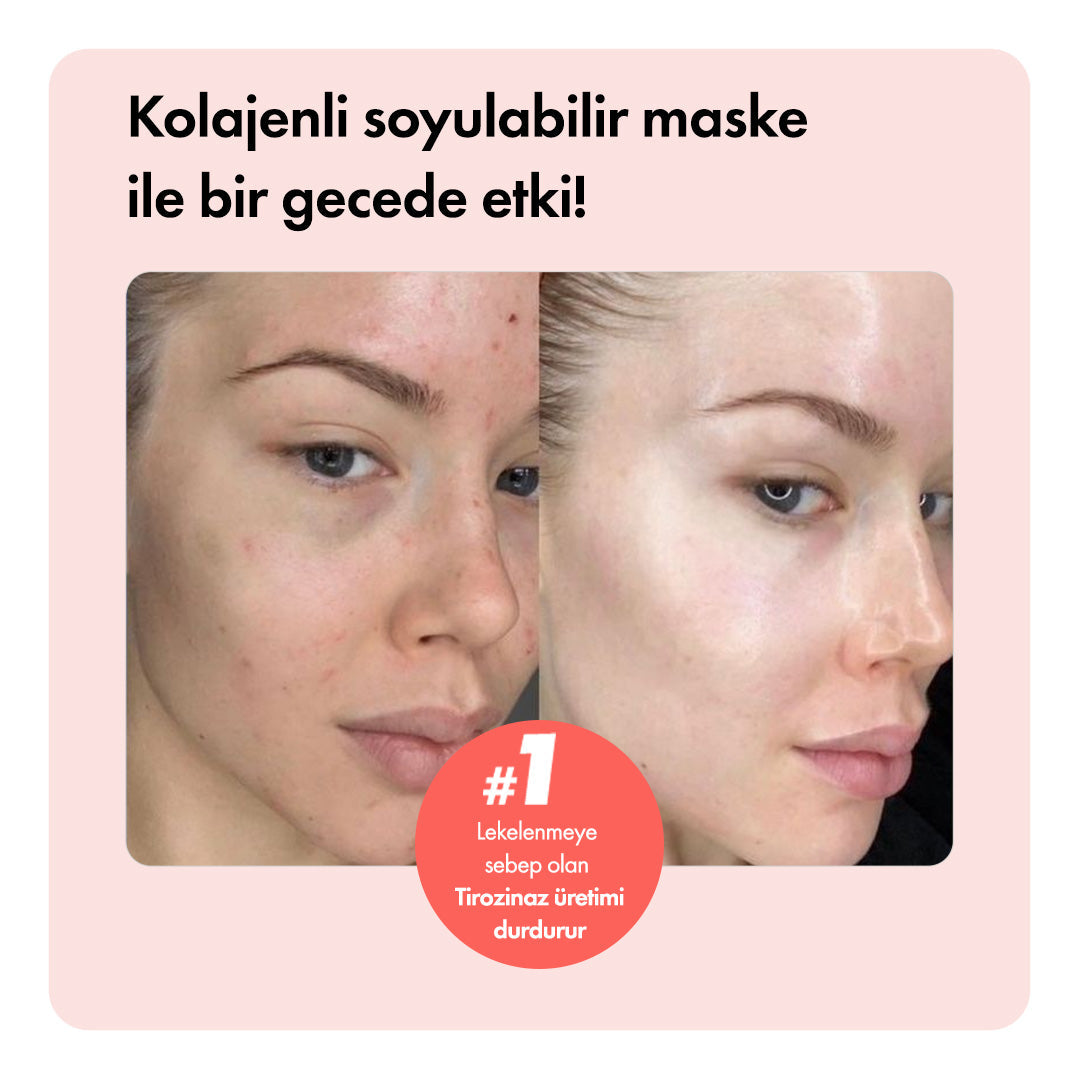 Collagen Night™ Soyulabilir Kolajen Maske ys-collagennight