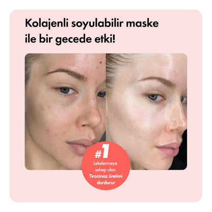 Collagen Night™ Soyulabilir Kolajen Maske LP
