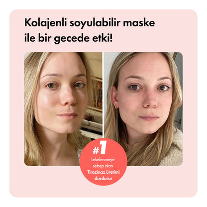 Collagen Night™ Soyulabilir Kolajen Maske LP