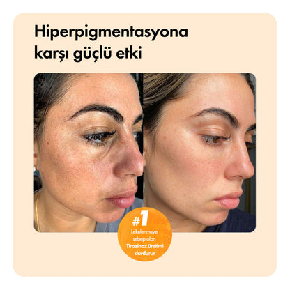 Kojiso™ Temizleme Barı ys-kojiso-cod