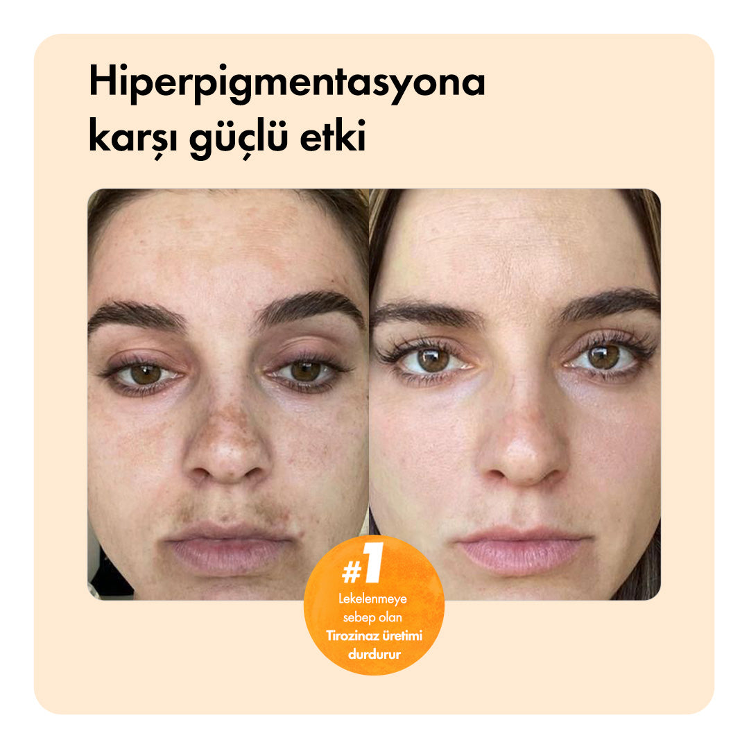 En Çok Satanlar Paketi