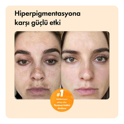 En Çok Satanlar Paketi