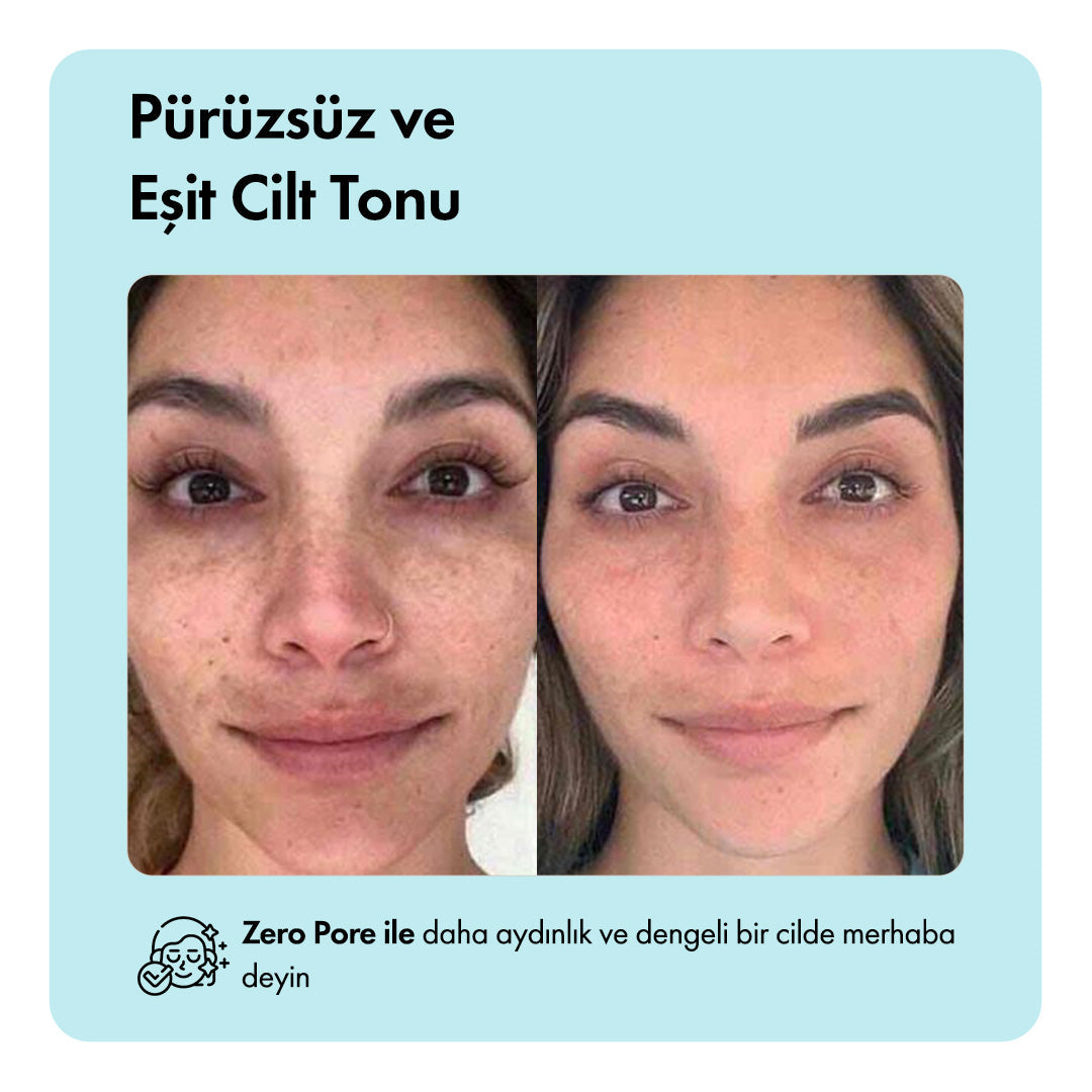Zero Pore™ Temizleme Barı ys-zeropore-cod