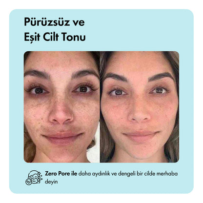 Zero Pore™ Temizleme Barı ys-zeropore-cod-tk